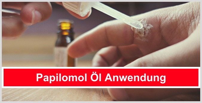 papilomol öl anwendung dosierung